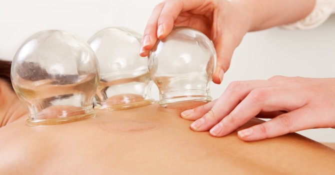 Cupping Decompression Therapy